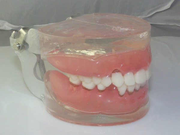 Dental Teaching Model for Gingival Disease Model