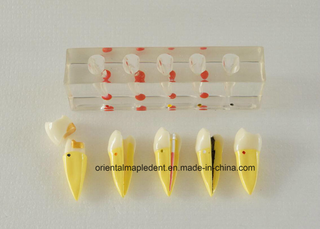 Dental Teeth Teaching Model for Endodontic Treatment