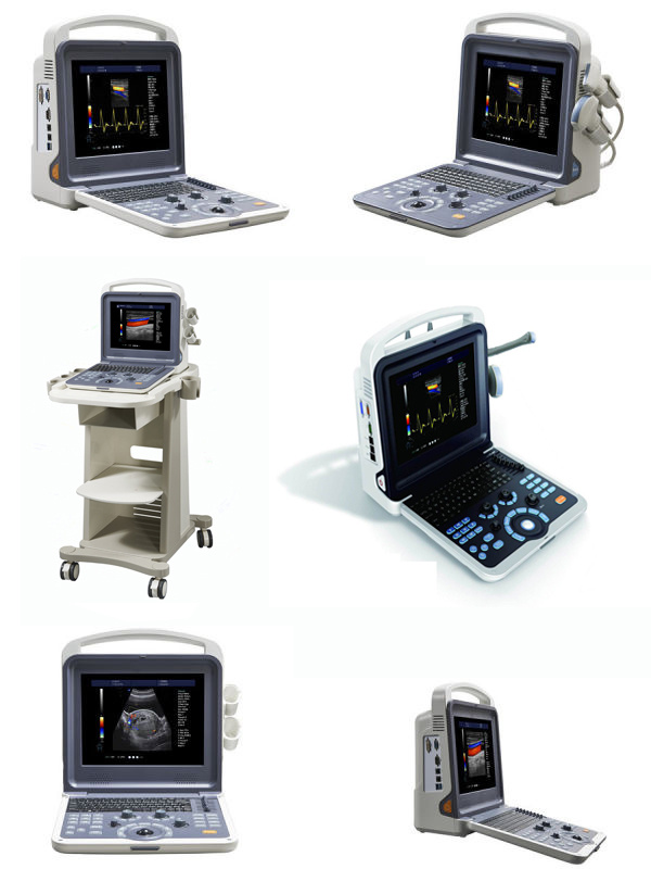 K6 Medical Touch Screen 3D/4D Portable Color Doppler Ultrasound