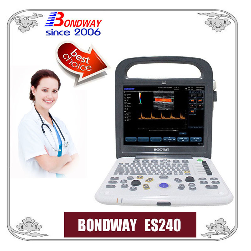 Ultrasound Portable Fetus Color Doppler, Es240, Ultrasound Machine, Doppler Ultrasound Equipmnet