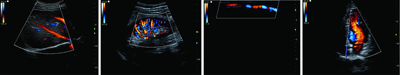 Doppler Machine, Digital Ultrasound Scan Machine, Color Doppler Ultrasound Imaging System, Diagnostic Ultrasound Scanner