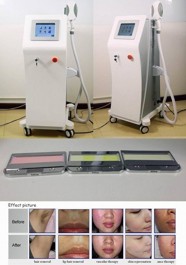 Painfree Hair Removal IPL Skin Rejuvenation Machine 3 Filers