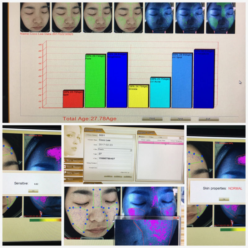 Wood Lamp 3D Skin Analyzer Beauty Equipment for Beauty Salon Cosmetic Company