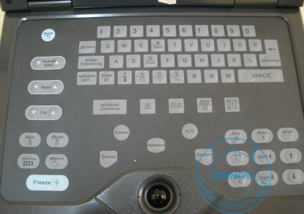 Laptop Ultrasound Scanner (SonoScan L1)
