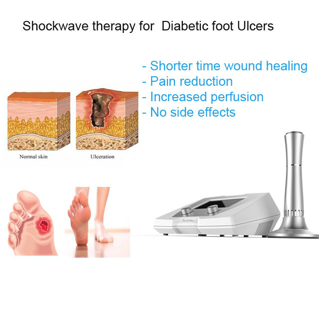 Extracorporeal Shock Wave Therapy in Wound Healing