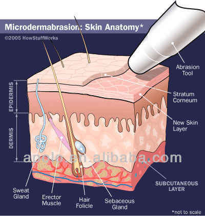 2 in 1 Microdermabrasion Beauty Machine for Skin Peeling (scar removal equipment HS-106)