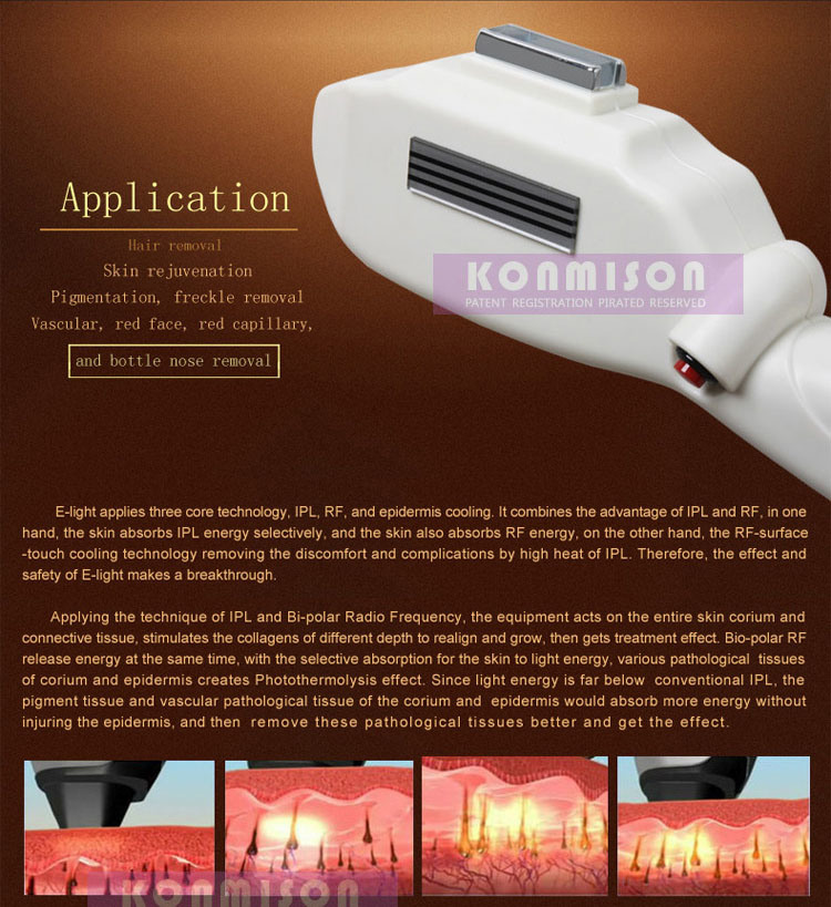 2 in 1 Elight Hair Removal Laser Tattoo Removal Machine