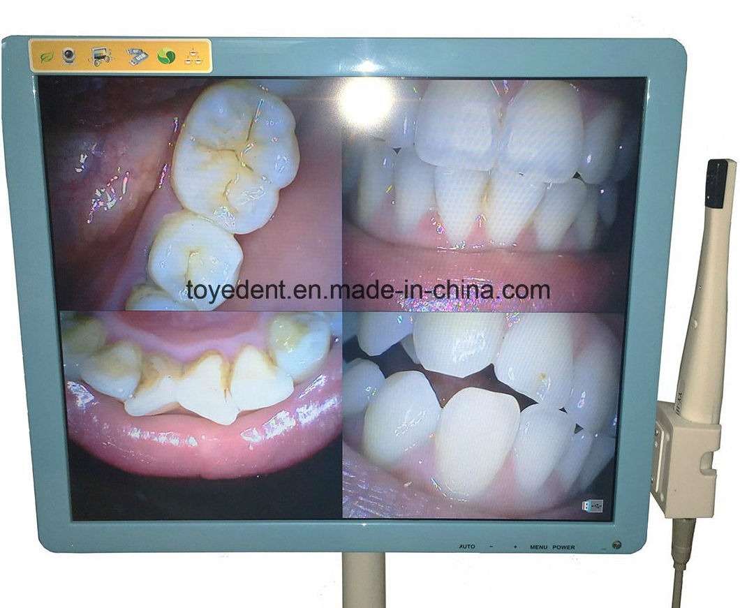 High Resolution Dental Camera Intra Oral VGA/USB