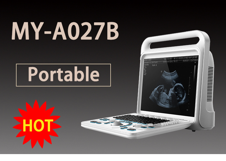 My-A027b Portable Echocardiography Machine Equipment 3D/4D Full Digital Color Doppler Ultrasound Scanner Price