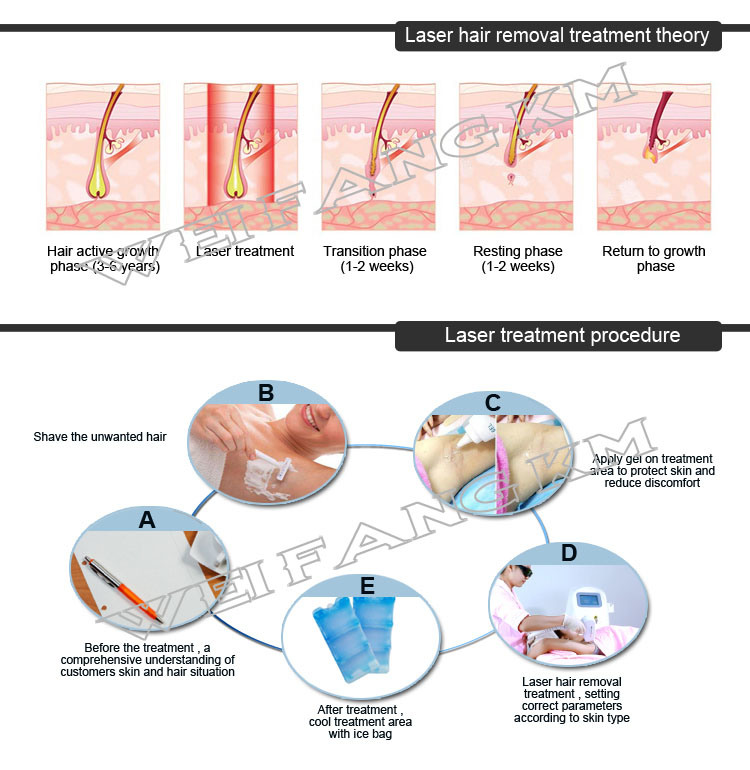 IPL Elight Shr RF Laser Hair Removal Machine 808nm Diode Equipment