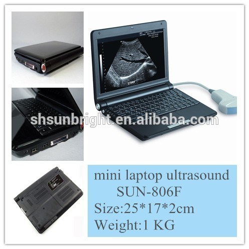 Factory Price Laptop Portable Ultrasound Scanner Sun-806f