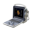 Color Doppler Ultrasound Scanner Sonography (K2)