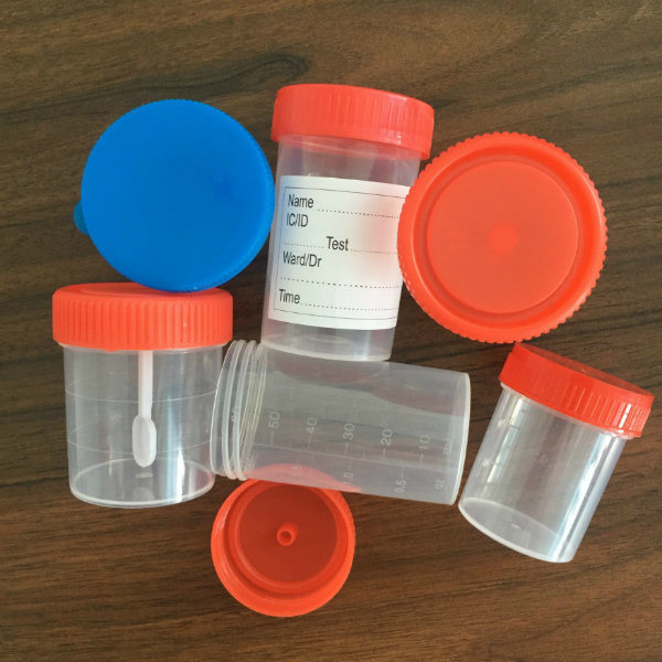 Medical Disposable Urine Specimen Container Manufacture