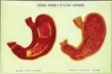 Xy-1577 Relief Model of Stomach