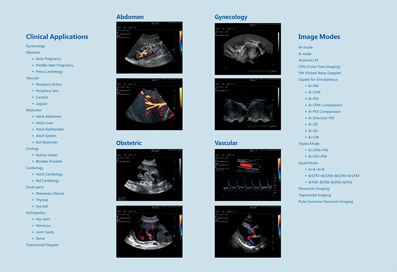 3D 4D Trolly Ultrasound System Color Doppler (AM- G60)