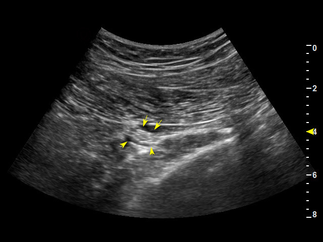 Multi-Functional Color Ultrasound Imaging System with Good Quality and Price -Mslcu58