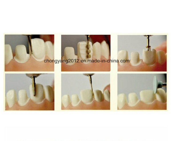 Dental Preparation Burs Porcelain Veneer Dental Burs 8PCS