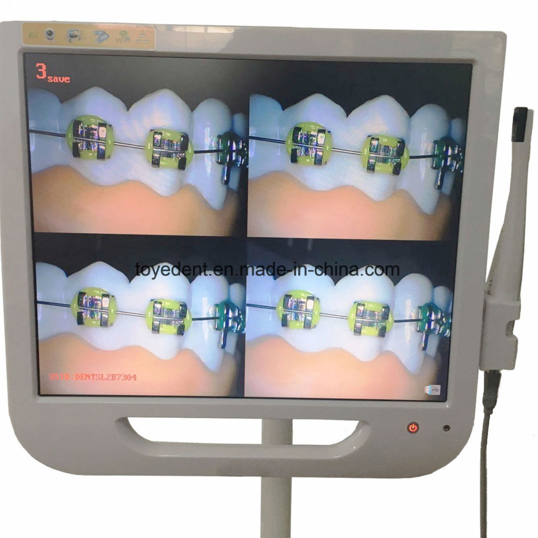 17'inch Dental Endoscope System Intra Oral Camera