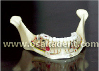 Dental Shape of Teeth Implant Teaching Model