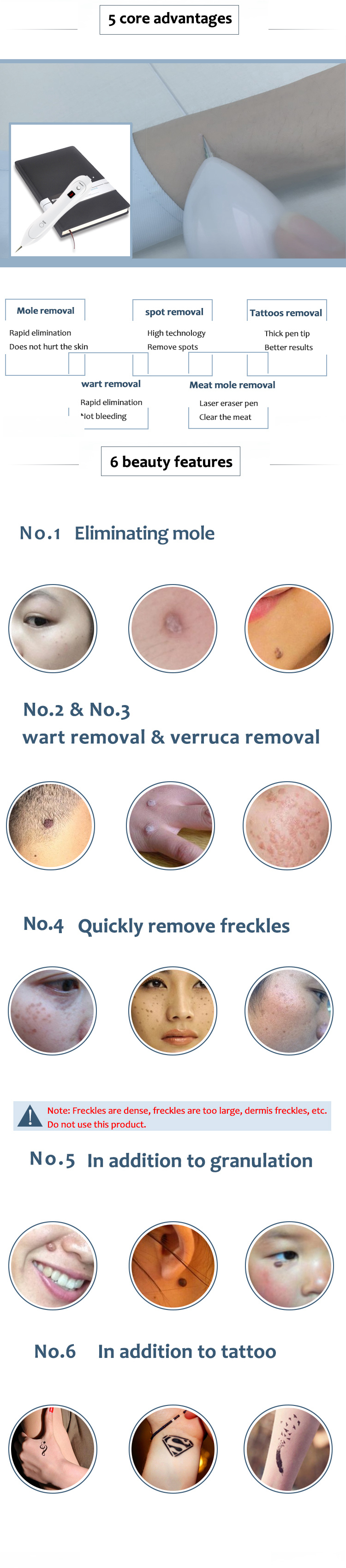 Laser Mole Tattoo Freckle Removal Pen LCD Sweep Spot Mole Removing Wart Corns Dark Spot Remover Salon Beauty Machine
