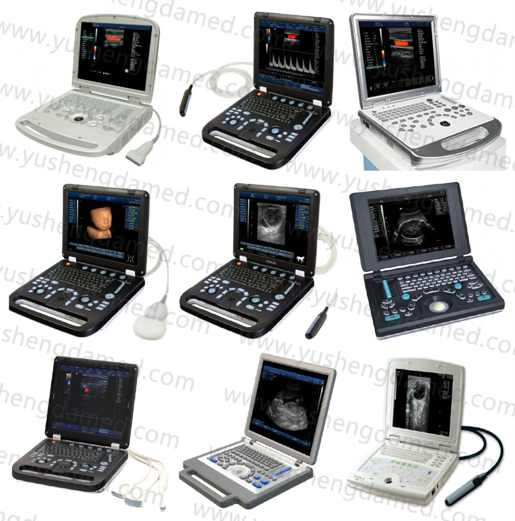 Ce Hospital Equipment Medical Diagnostic Ultrasounic Machine Digital Laptop Ultrasound