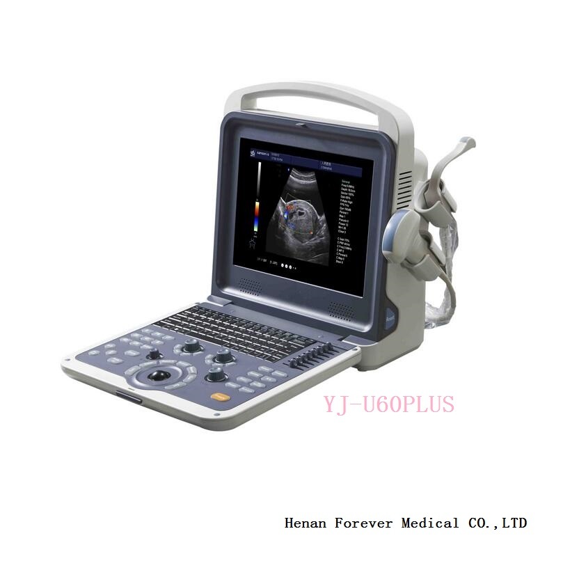 Manufacturer Laptop Color Doppler Ultrasound Scanner with Cw Mode (YJ-U60PLUS)