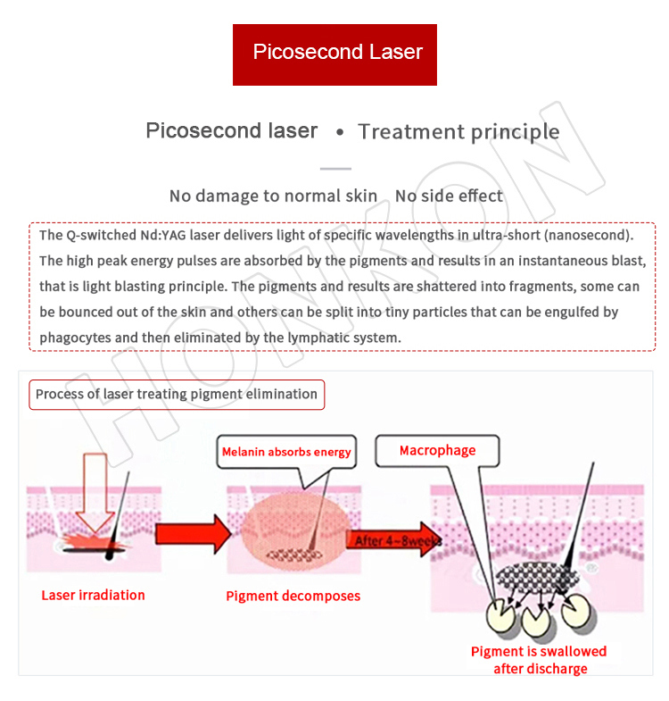 Professional Picosecond 1064nm Laser Melasma Pigmentation Tattoo Removal Beauty Equipment