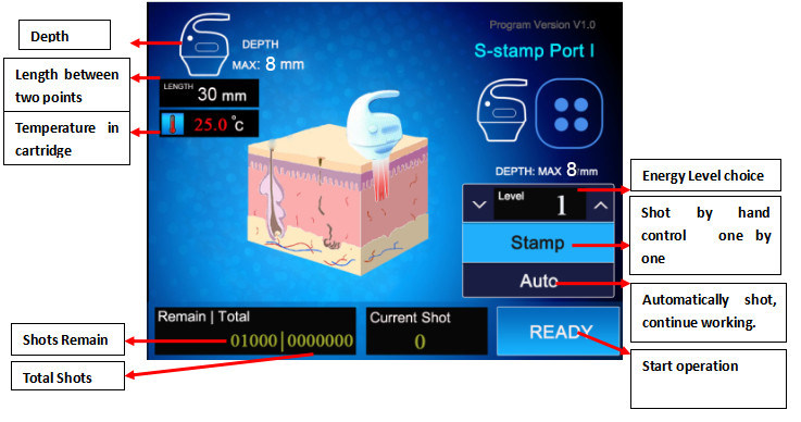 Weight Loss Ultrashape Hifu Ultrasound with 20000 Shots Life