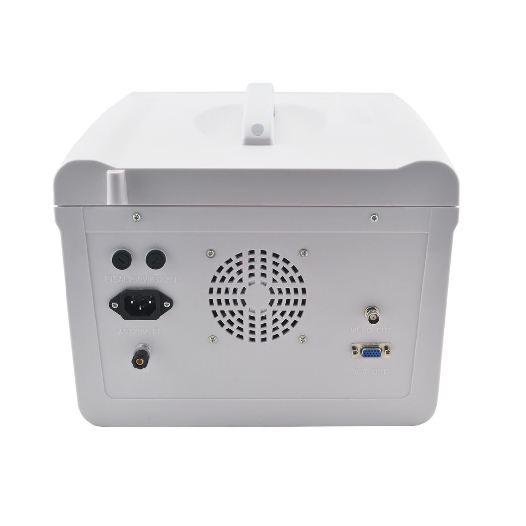 Good Price Diagnostic Ultrasonic System Ultrasound Scanner -- Alisa