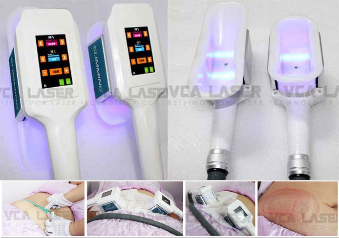 Beauty Salon Freeze Fat Cryolipolysis Slimming Machine (VC15)