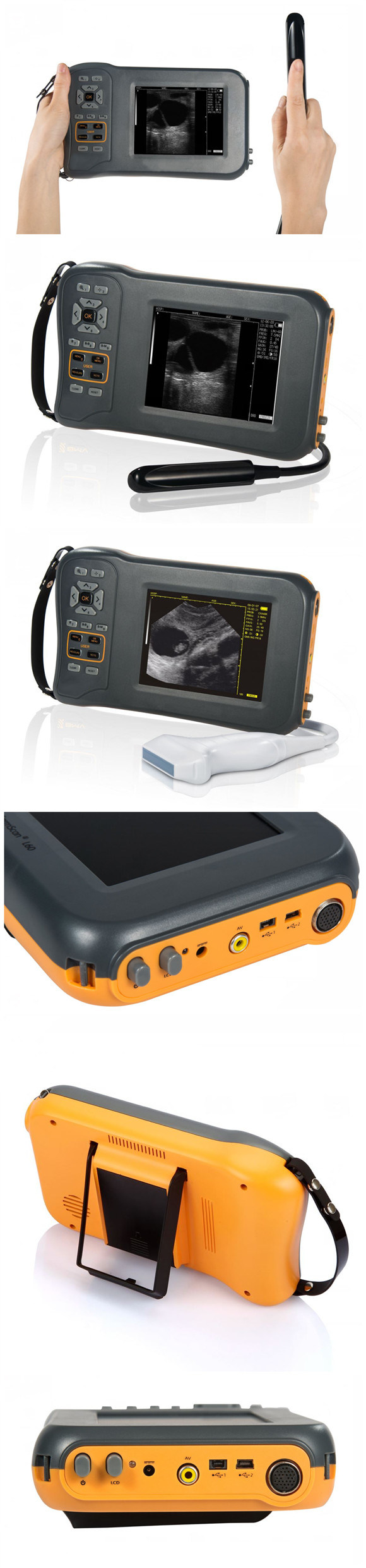 Farmscan L60 B Mode Handheld Laptop Pet Vet Veterinary Ultrasound Scanner