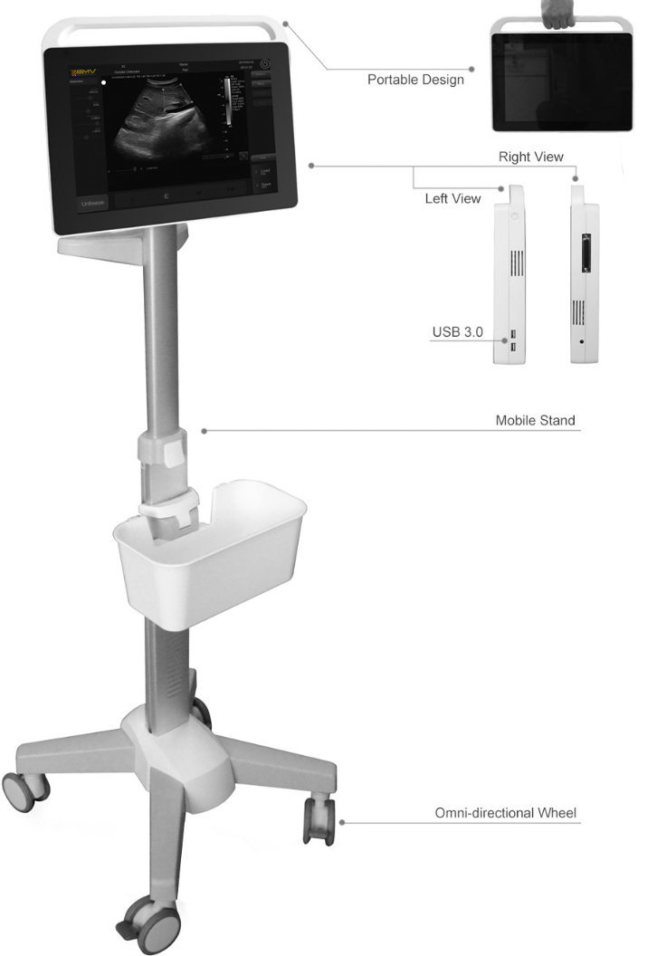 Hospital Equipment Portable Ultrasound 3D Baby Ultrasound