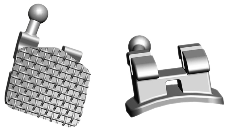 Mini Roth/Mbt V-Slot Brackets in Orthodontics