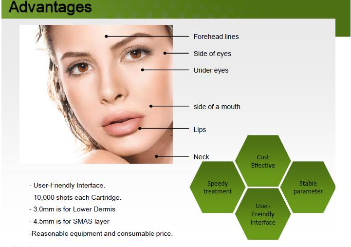 New Innovative Anti-Aging Face Lift Slimming Machine Hifu (US310)