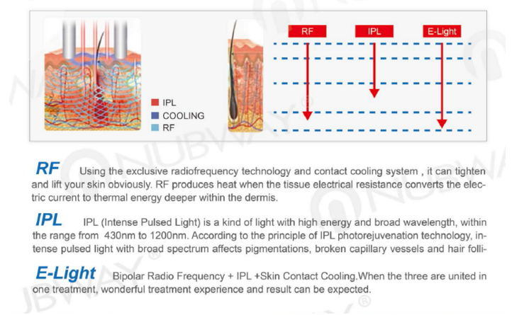 Portable IPL+RF+Elight 3 in 1 Photo Rejuvenation Machine