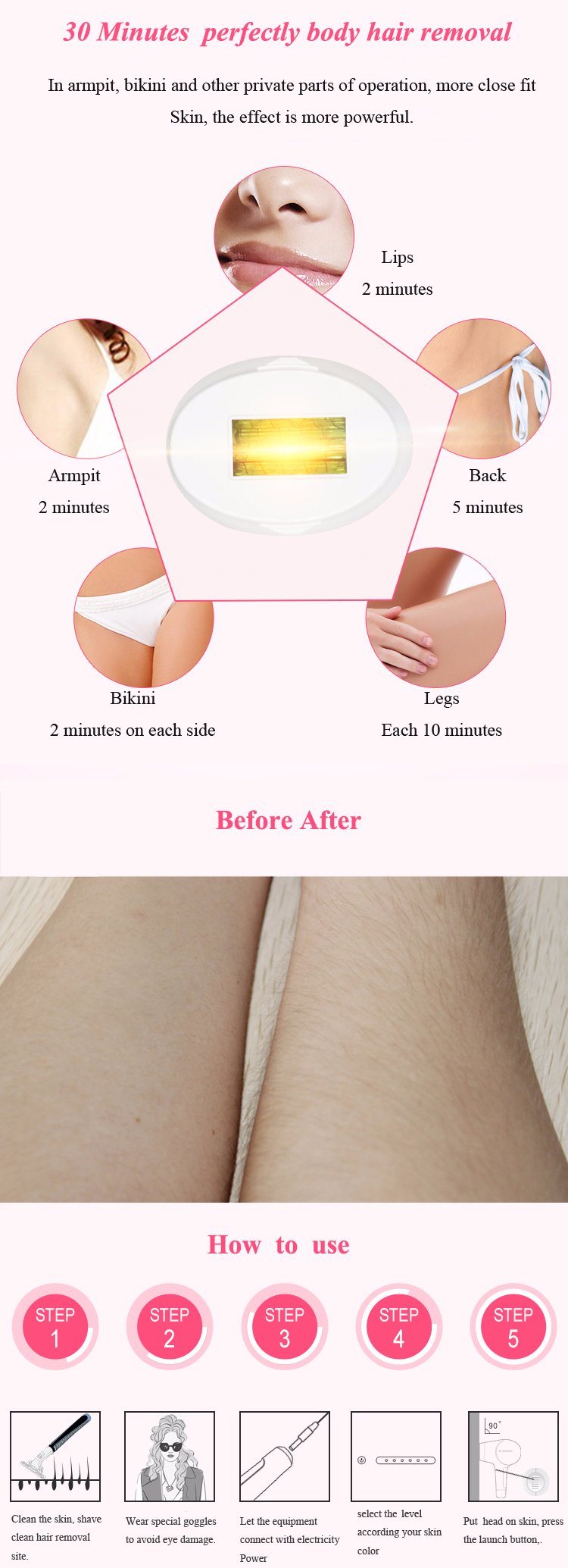 Mini IPL Hair Removal by Intense Pulse Light Technology