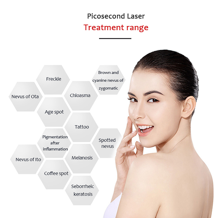 Tattoo Pigment Age Spot Melasma Removal Laser Machine