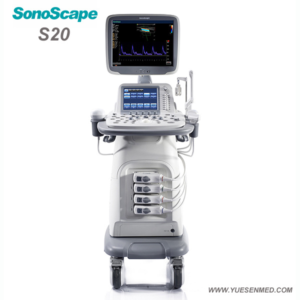 Hospital Medical Sonoscape S20 Mobile Trolley Color Doppler Machine