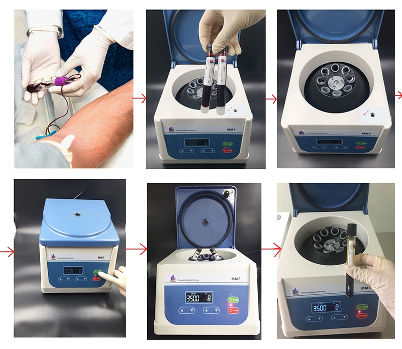 Factory Direct Supply Promotional Centrifuge with ISO Standard