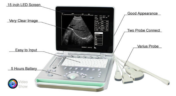 Hbw-7 B/W High Quality Laptop B Diagnostic Ultrasound Scanner