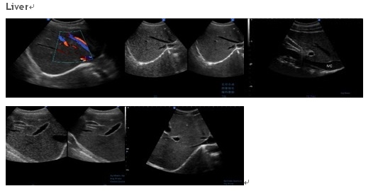 Ce, FDA Approved 4D Color Doppler Ispark 480