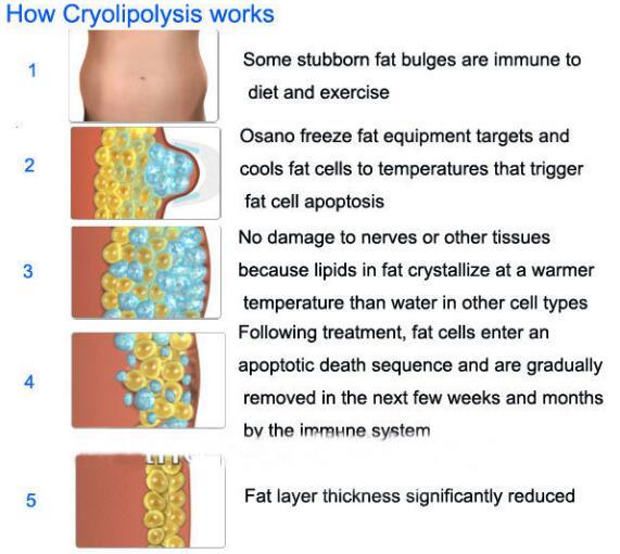 Professional Cryolipolysis Body Sculpting Weight Loss Slimming Equipment