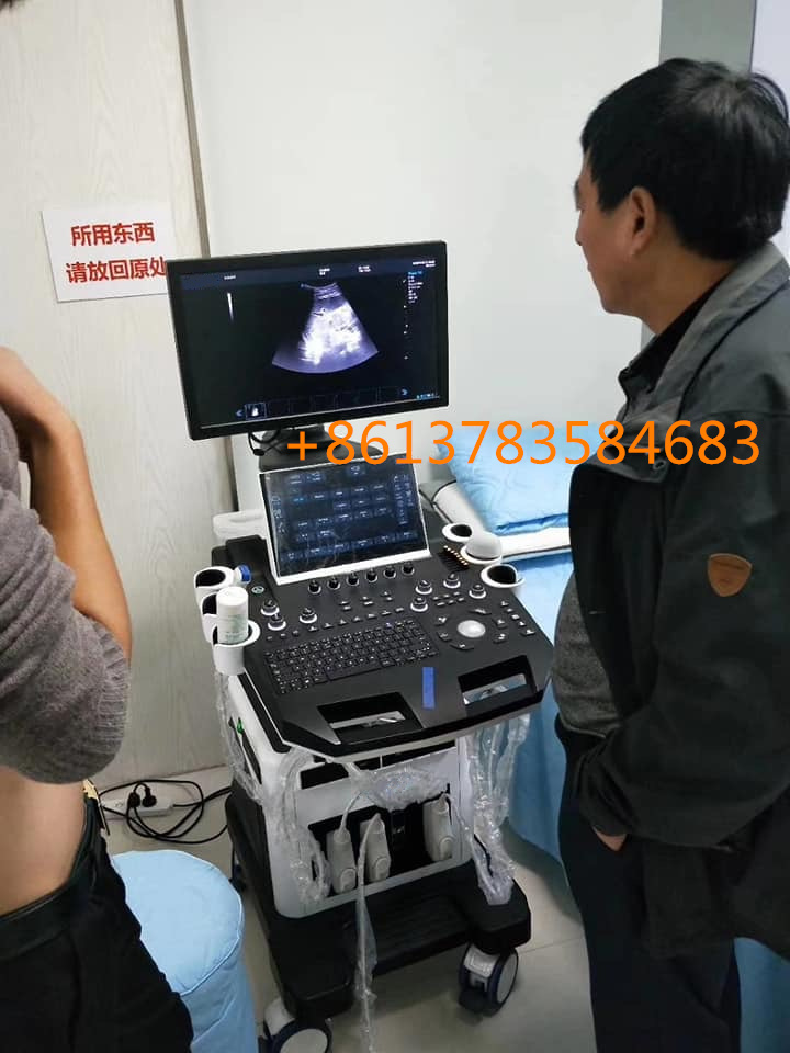 Ce Approved Trolley 4D Color Doppler Ultrasound Scanner for Gynecology