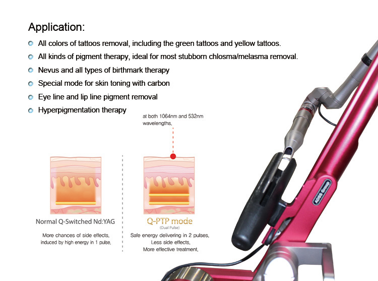 Q Switch ND YAG Laser Tattoo Removal and Pigment Problem