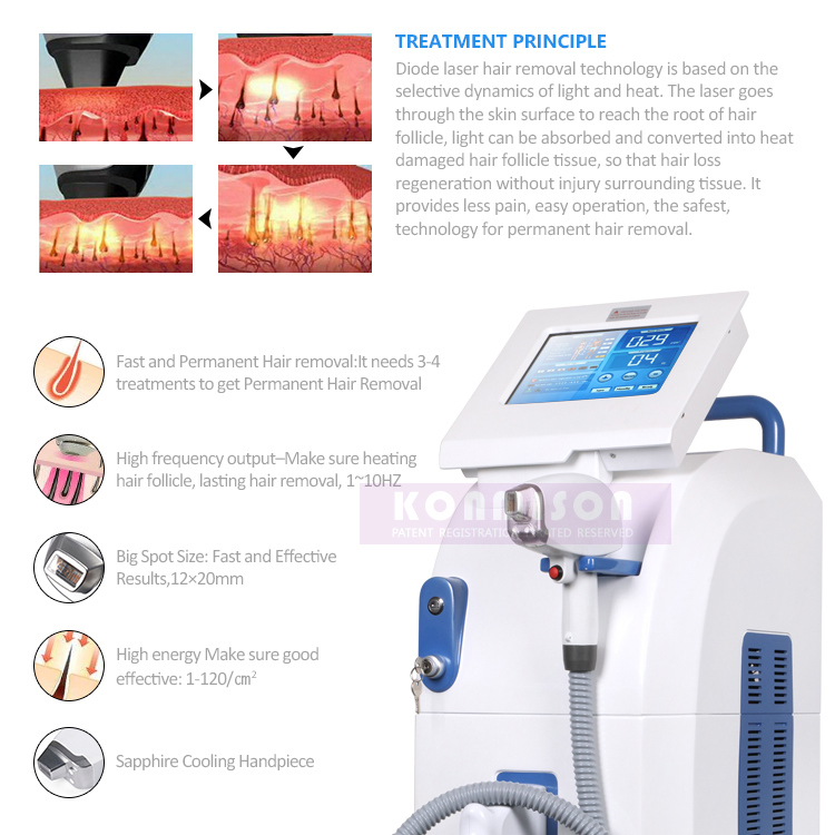 Professional Salon Use Laser Soprano 808nm Diode Laser Hair Removal Machine