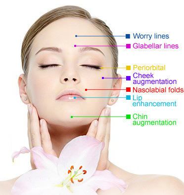 Singfiller Facial Hyaluronate Acid Dermal Filler Fine Lines