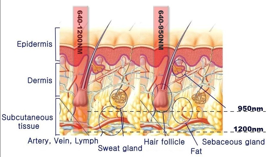 Salon Shr Hair Removal IPL Equipment / Medical Laser Hair Removal Beauty Machine
