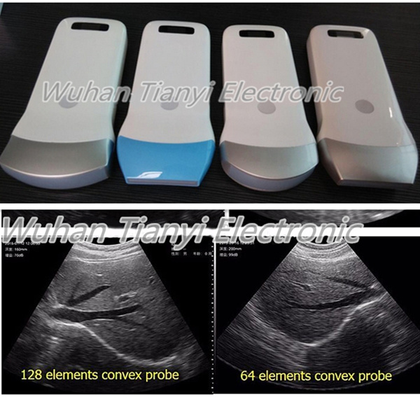 Manufacturer Wireless Ultrasound Scanner for iPhone iPad Smartphone