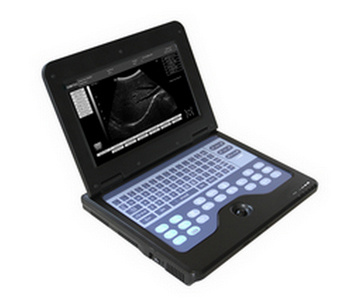 Contec Cms600p2 Portable Ultrasound Scanner Machine Medical Equipment