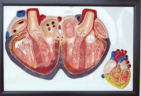 Xy-1576-1 Relief Model of Human Heart